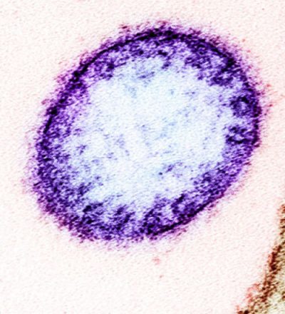 World’s Oldest Person Lived to 122; Recalled Van Gogh Was 'Drunk and